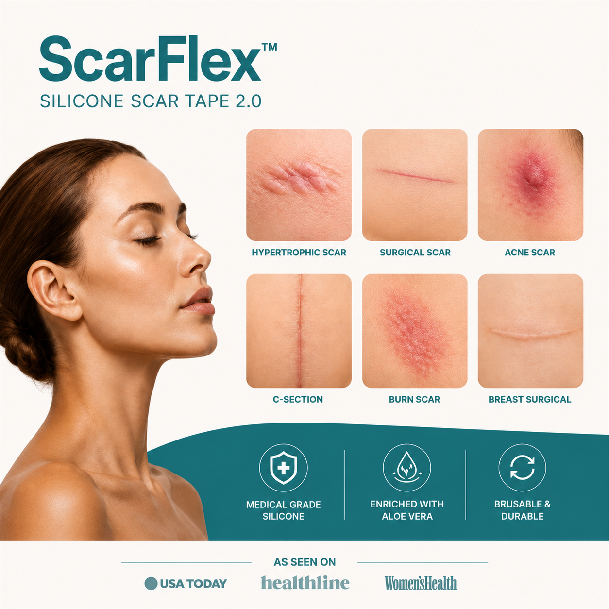 ScarFlex™ - Silicone Scar Tape